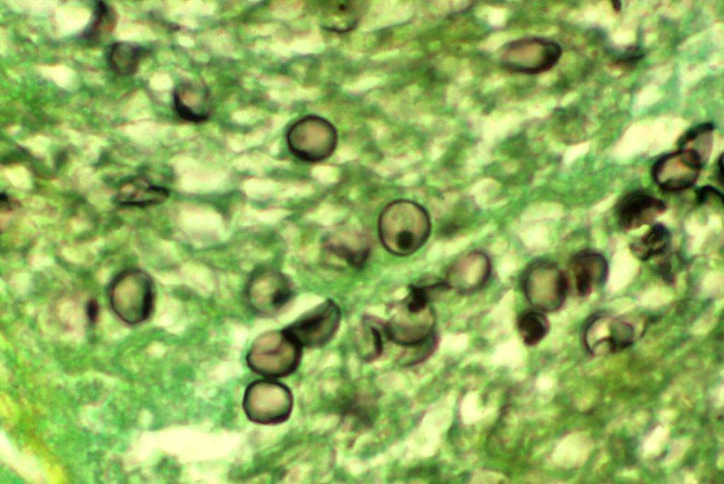 Pneumocystis carinii