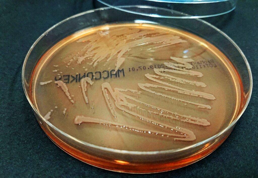 S. maltophilia su MacConkey Agar