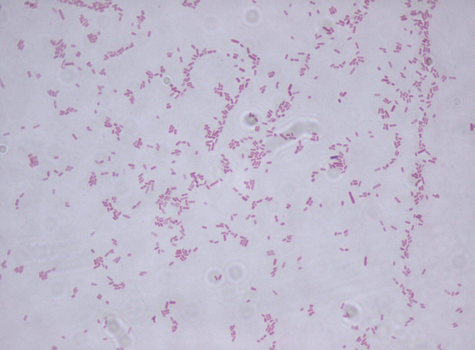 Stenotrophomonas maltophilia - scheda batteriologica ed approfondimenti