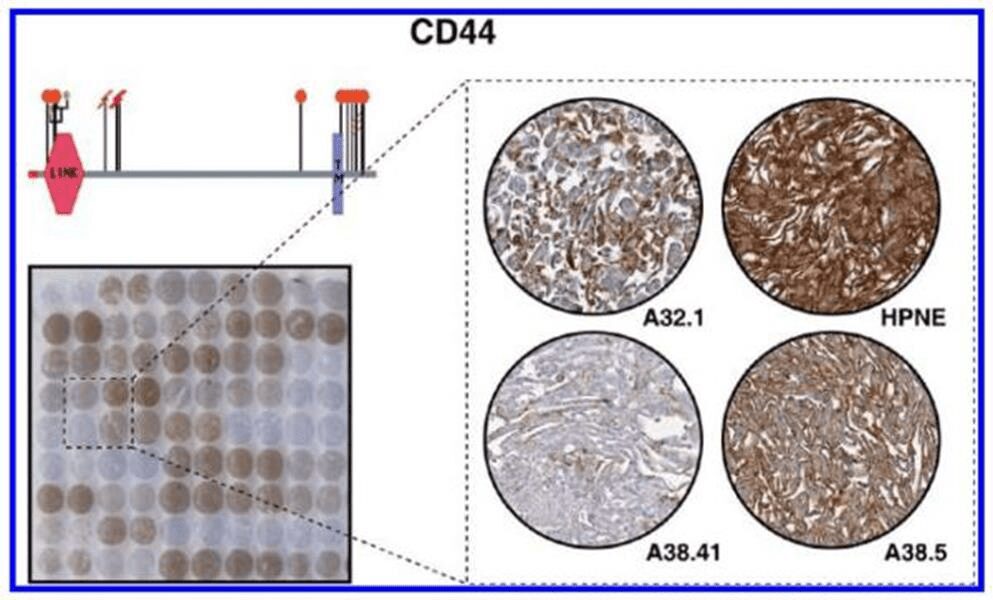 Figura 2- colorazione immunocitochimica di CD44. Nel pannello in alto a sinistra è mostrata la struttura del dominio di CD44, il colore rosso indica il peptide segnale e TM il dominio trans membrana (Fonte Pubmed)