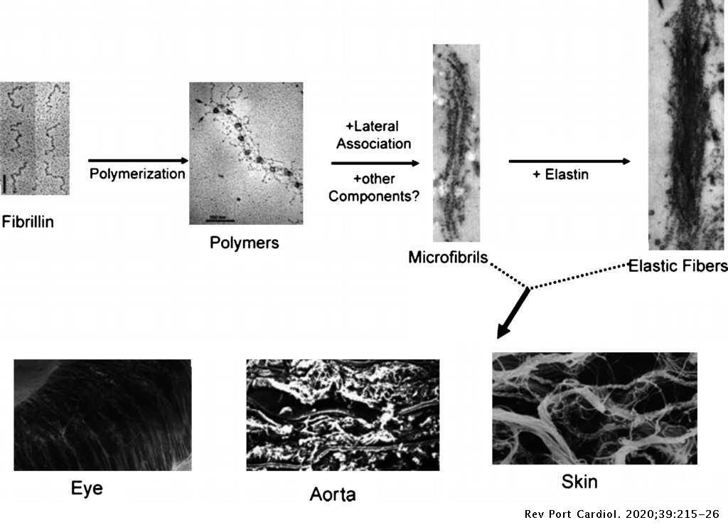 Rappresentazione schematica delle principali fasi alla base della formazione delle microfibrille e delle fibre elastiche 