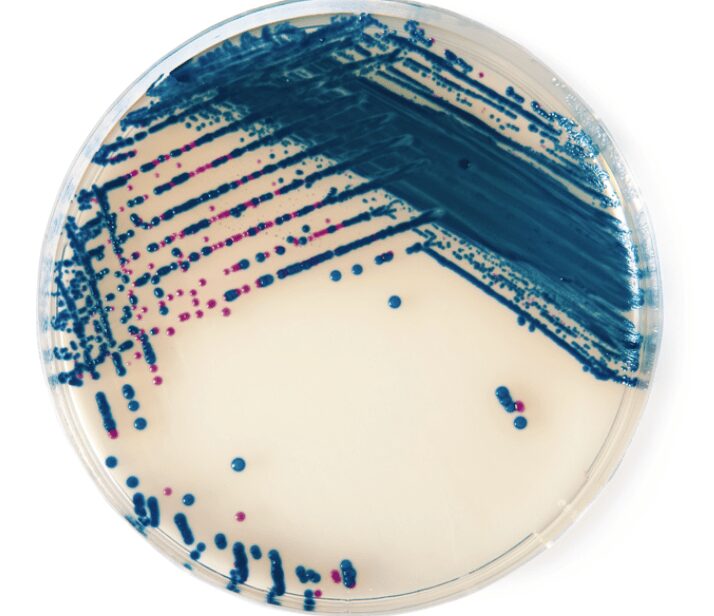 StrepB agar con colonie fucsia di streptococchi di gruppo B (es. S. agalactiae) e colonie blu di altri microrganismi