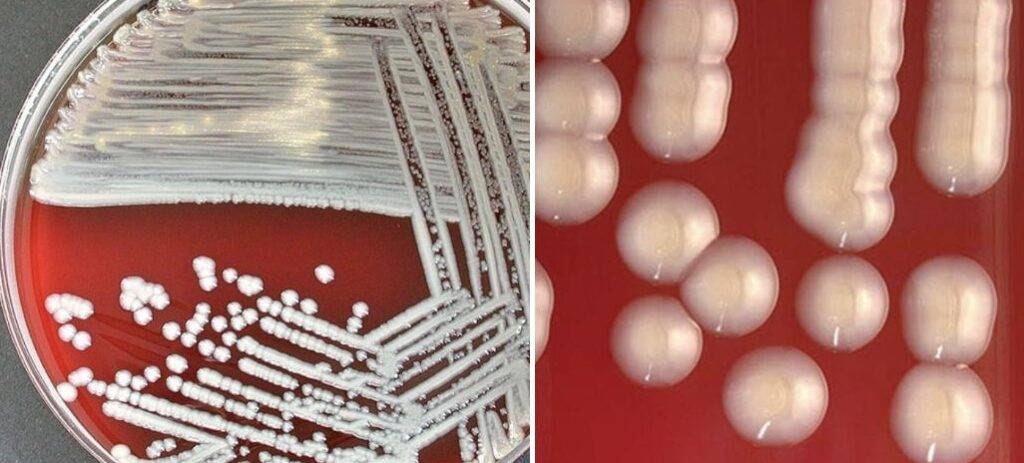 Figura 2 – Colonie di E. meningoseptica su agar sangue