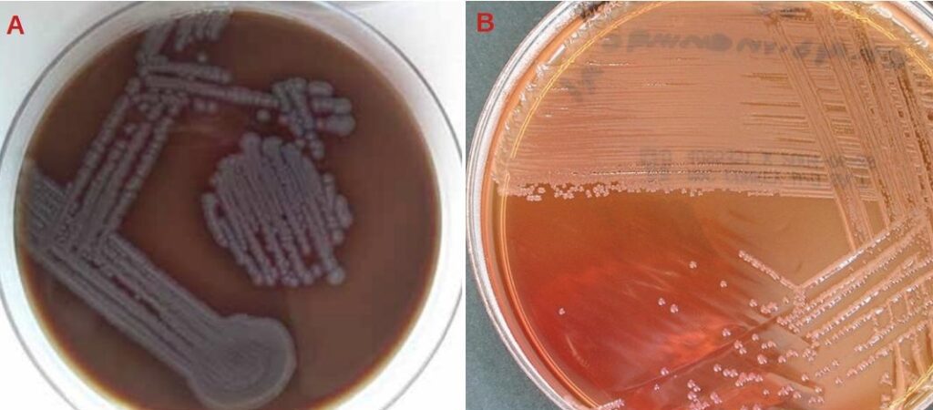 Figura 3 – Colonie di E. meningoseptica su agar cioccolato (A) e su agar MacConkey