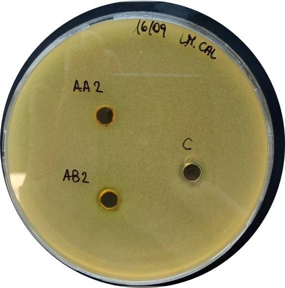 Figura 2 - Analisi di L. monocytogenes in piastra da microbiologia