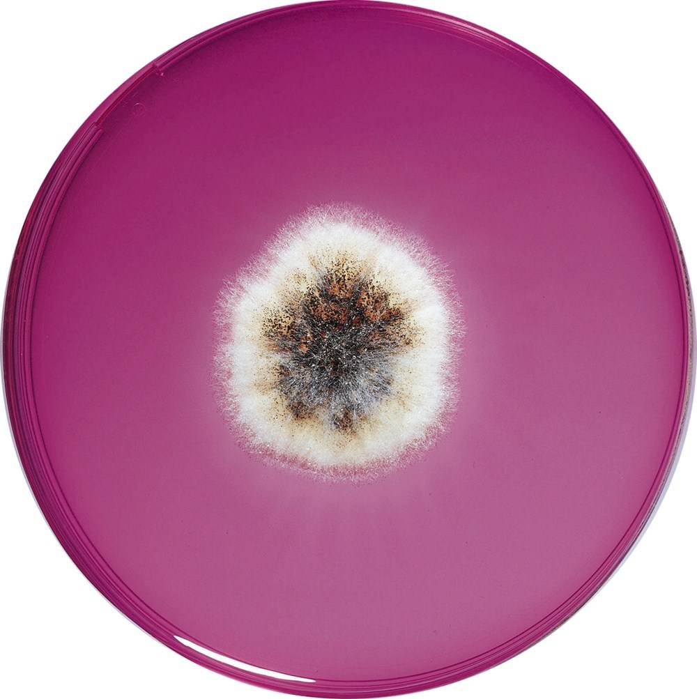 Rose Bengal Agar Medium – Rose Bengale Chloramphénicol – MIQG