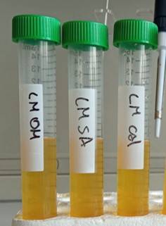Figura 1 - Colture liquide di diversi ceppi di L. monocytogenes