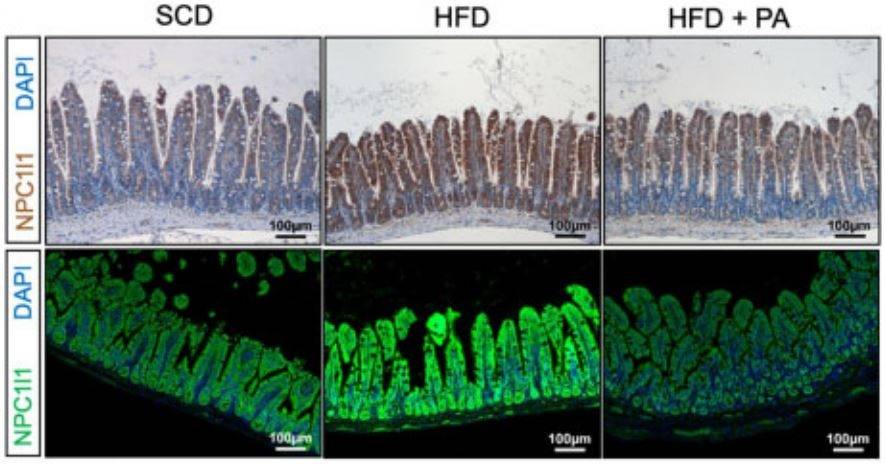 Figura 2 - Immunofluorescenza e immunoistochimica su sezioni istologiche intestinali. Come si può notare, i topi alimentati con grandi quantità di lipidi (HFD) l'espressione di NPC1L1 è elevata, ma si abbassa in seguito a somministrazione di propionato (HFD + PA)