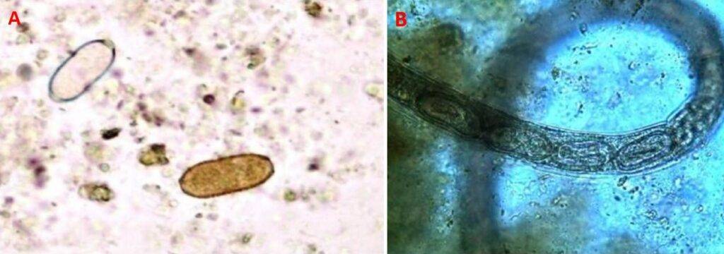 Figura 3 – A) Uova con guscio sottile e uova con guscio spesso. B) Uova con le larve nell’utero della femmina