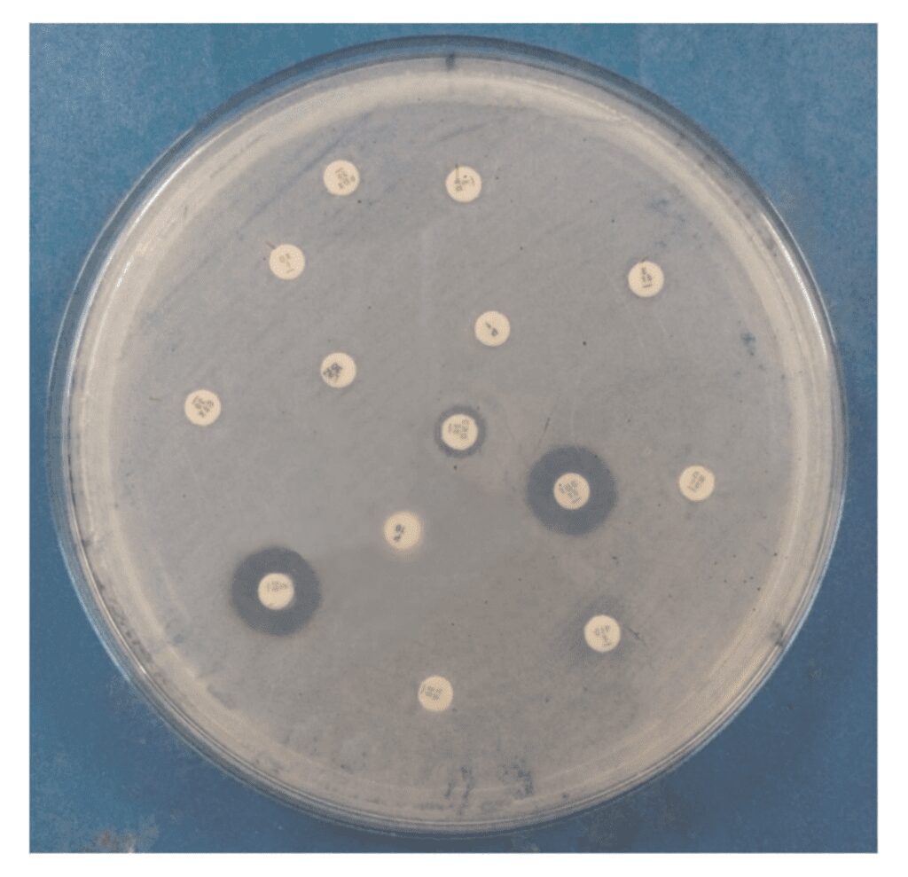 Saggio di resistenza agli antibiotici di Acinetobacter
ceppo calcoaceticus STP14