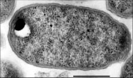 immagine di Agrobacterium tumefaciens al TEM