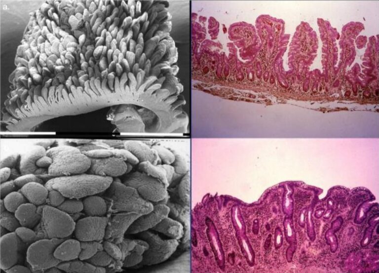 Microbiota intestinale: generalità e funzioni