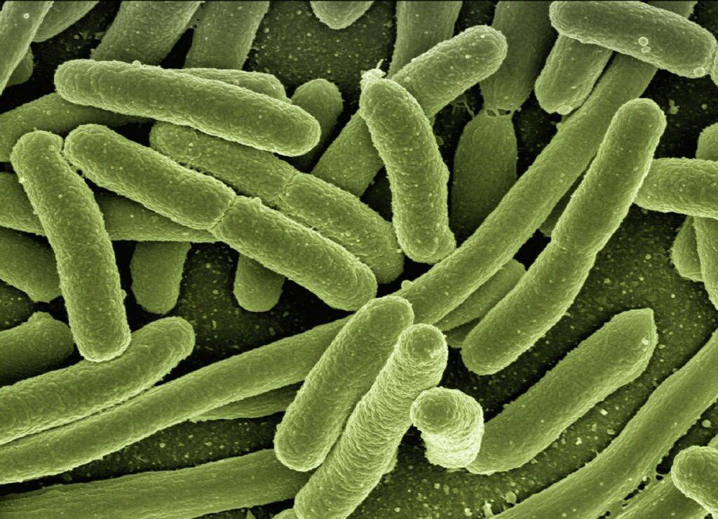 colonia di Escherichia coli