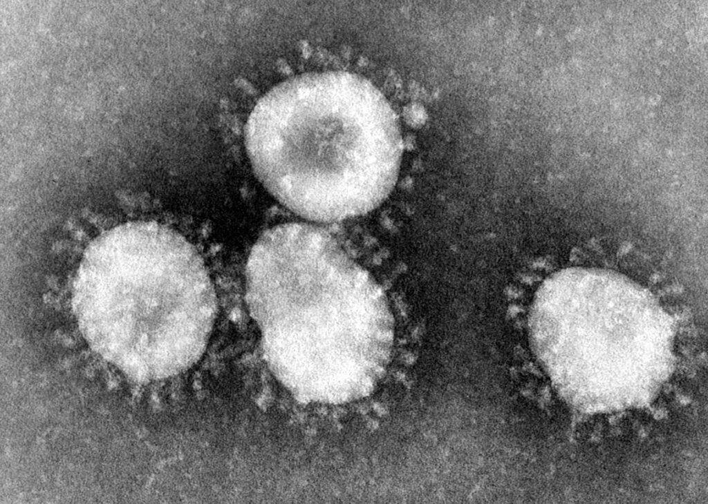 Coronavirus SARS visto al microscopio elettronico
