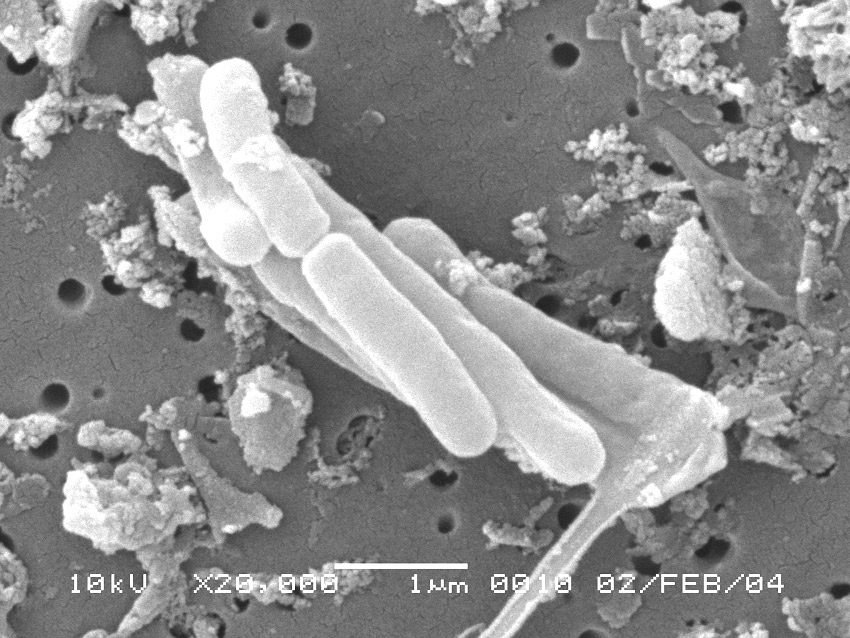 Mycobacterium marinum - Acquari e rischio microbiologico