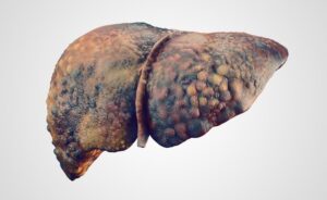 fegato grasso e prebiotici