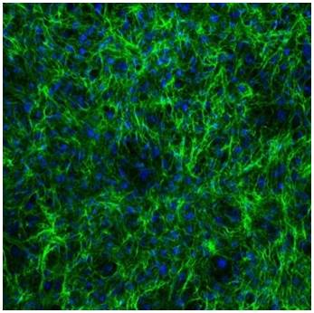 Osservazione con immunofluorescenza indiretta di una proteina di matrice e dei nuclei cellulari.