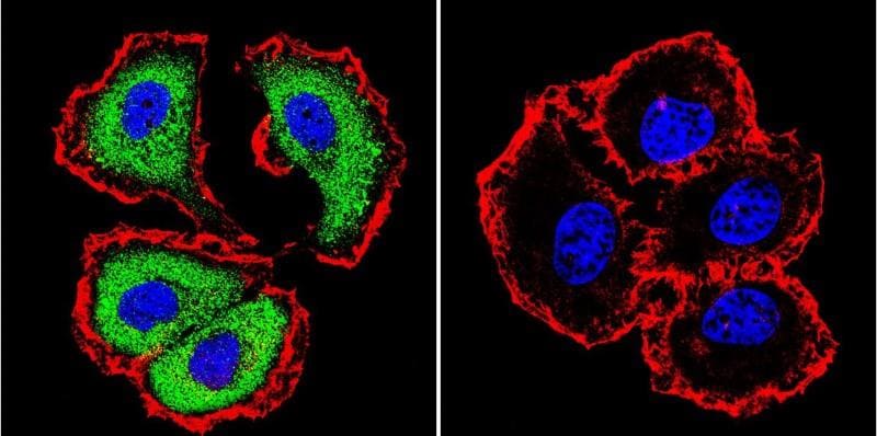 Immagine di doppia immunofluorescenza  con contro-colorazione nucleare