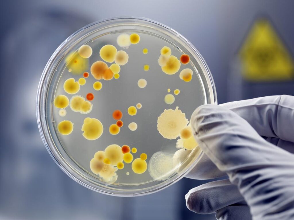 Infection bacteria cultured in labortaory