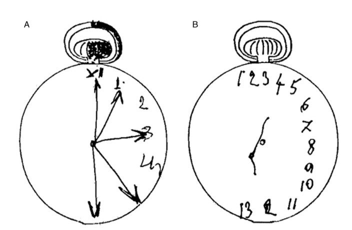Memory task per diagnosi negligenza spaziale