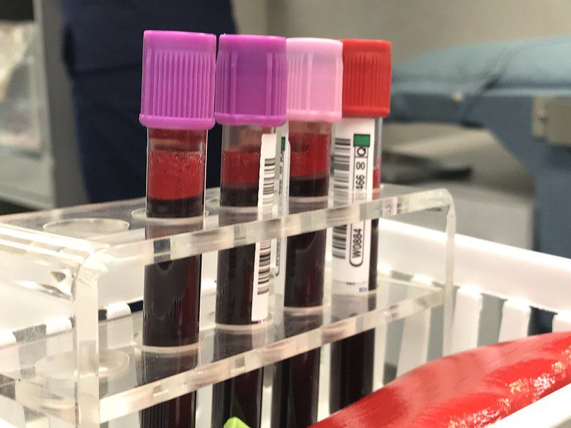 Esami del sangue per diagnosticare l'ipomagnesemia