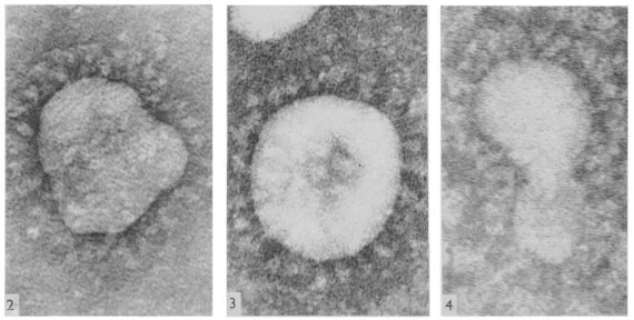 Le prime immagini microscopiche dei coronavirus umani scattate da Almeida e Tyrrell