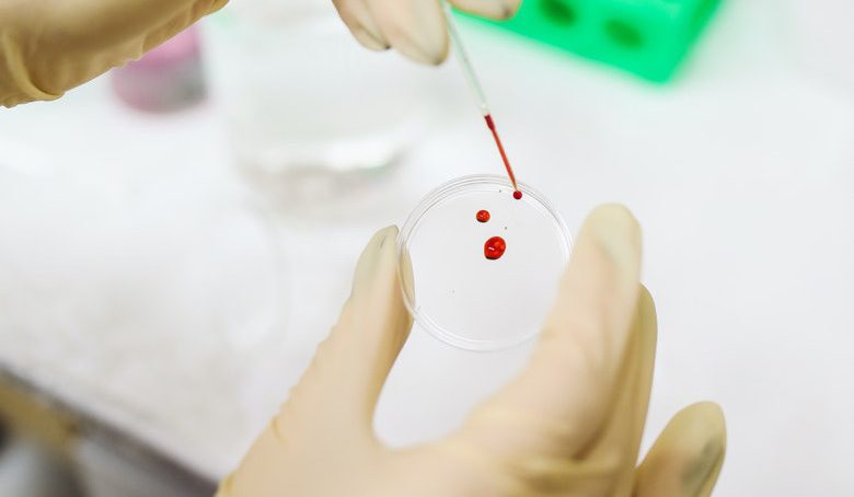 Esame di routine su campione ematico per la ricerca tossicologica.