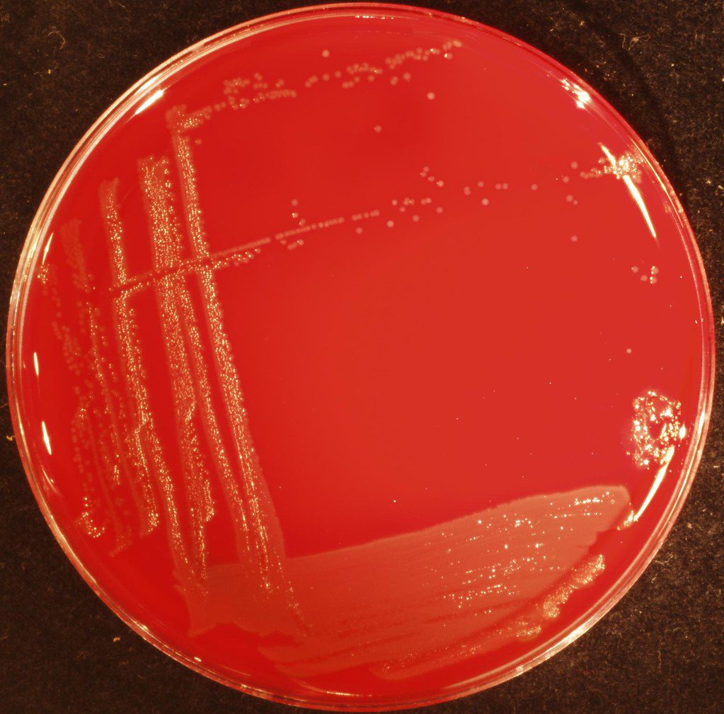 Figura 2 - Piastra di agar sangue con crescita di colonie [flickr.com]