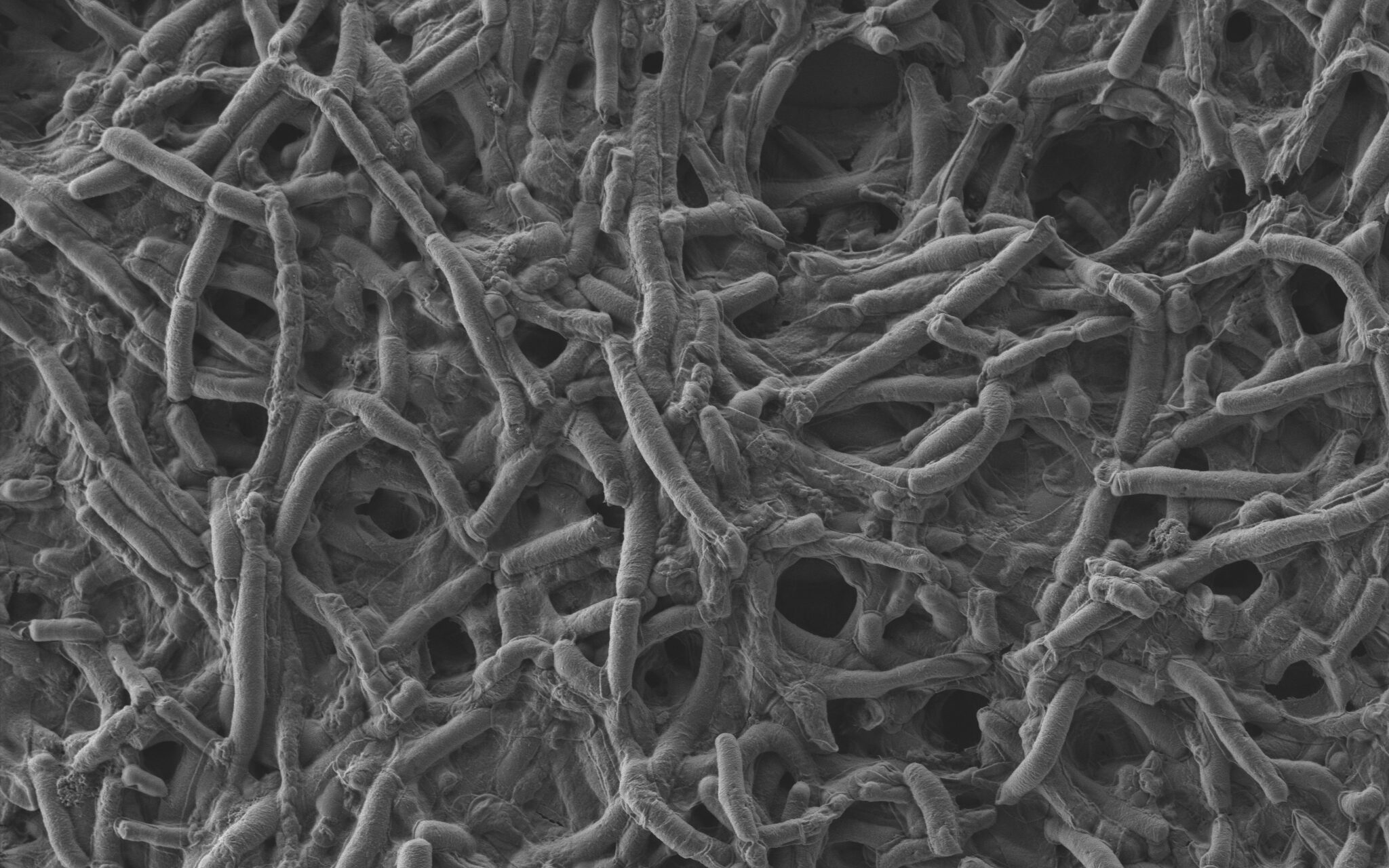 Altro meccanismo di resistenza è la formazione di biofilm.