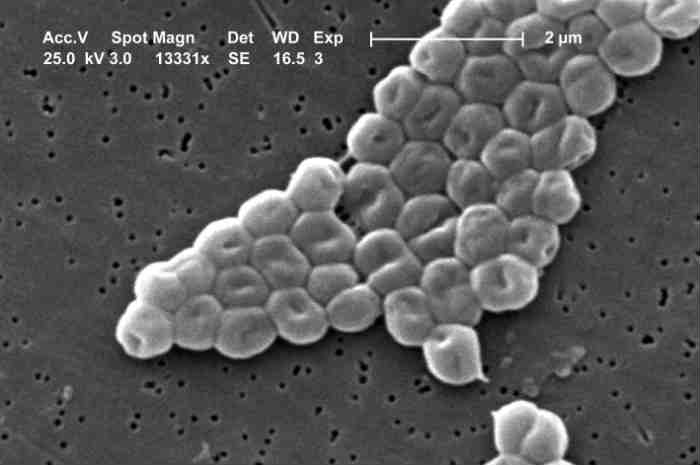 l'intelligenza artificiale scopre un antibiotico contro Acinetobacter baumannii