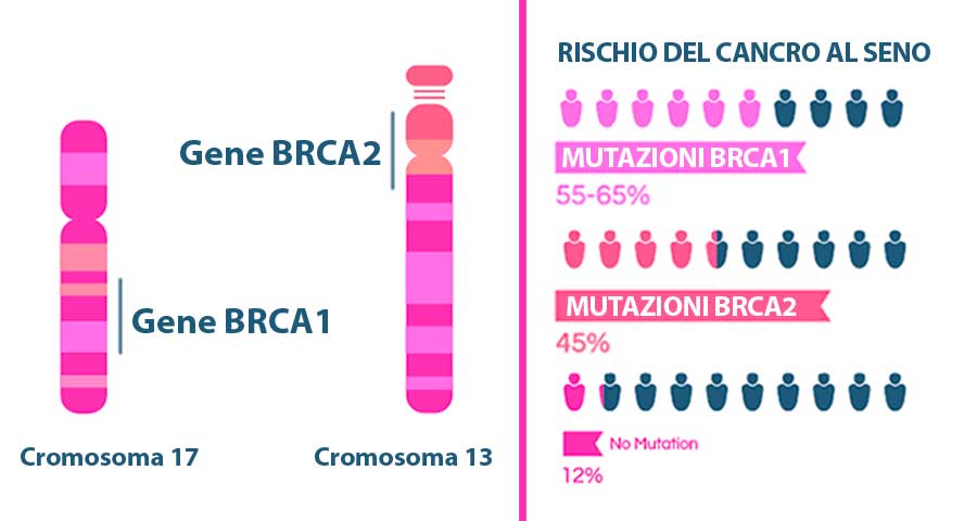Aumento del rischio di cancro al seno con mutazioni BRCA1 e BRCA2