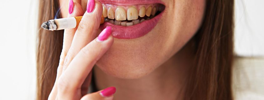 la sigaretta elettronica ingiallisce i denti Le Migliori Pod Mod Sigarette Elettroniche main image 1