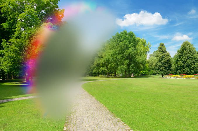 emicrania con aura
