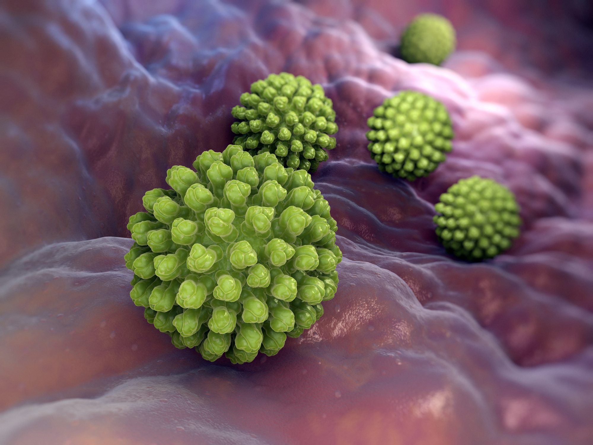 Infezioni da Rotavirus