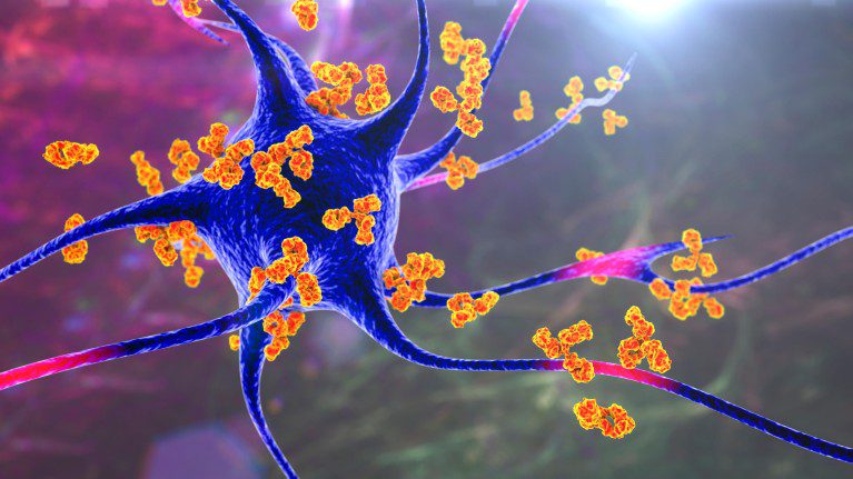 Malattie Autoimmuni al Femminile