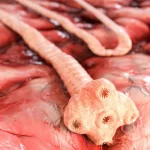 Il Verme Vivo nel Cervello