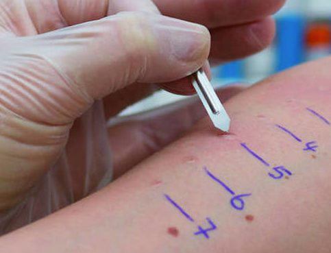 Influenza della Pelle sulle Allergie Alimentari
