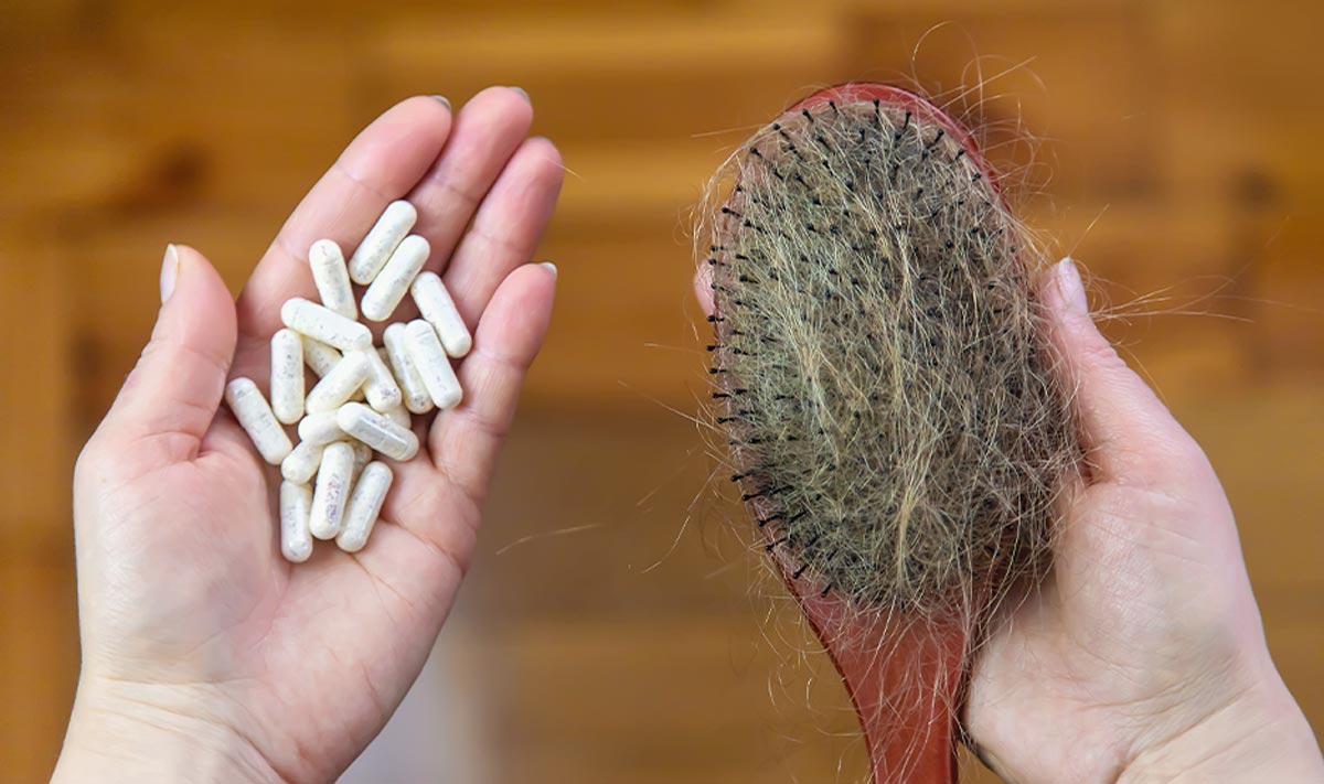 Suplementos para prevenir la caída del cabello: Opciones efectivas