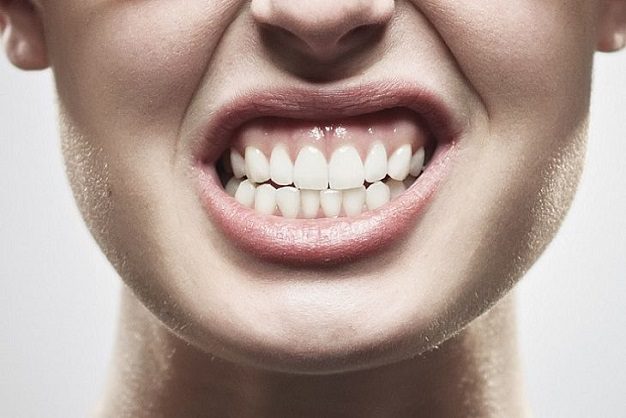 La Relazione Tra l'Ansia e i Problemi Dentali
