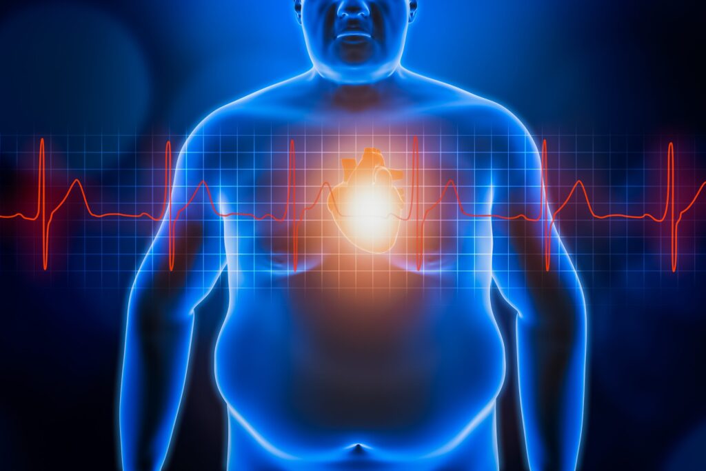 Obesità e Salute del Cuore