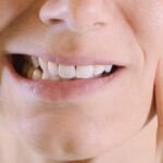 Gli Effetti dello Stress sulla Salute Dentale