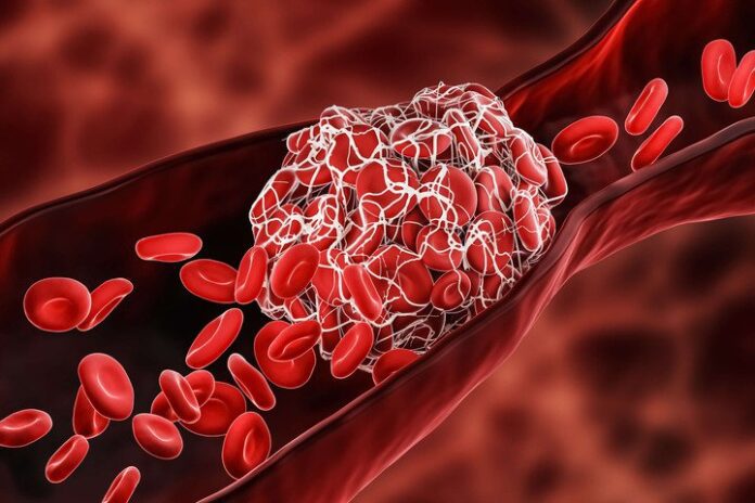 Malattie della Coagulazione