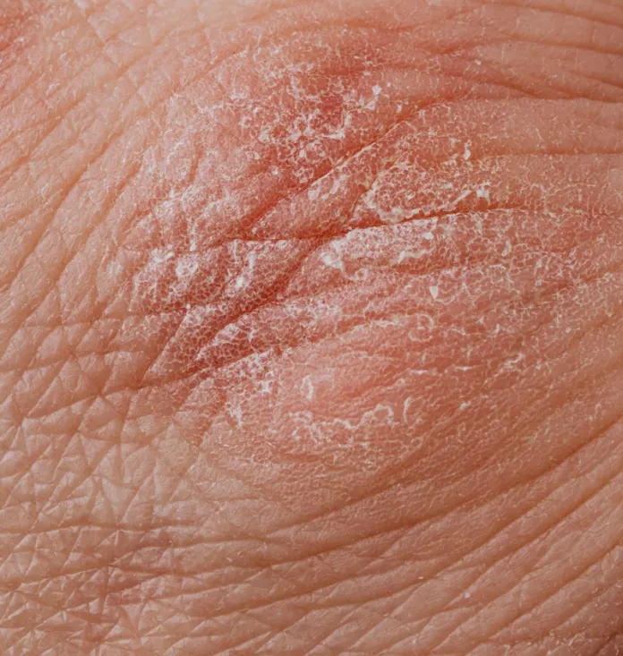 I Benefici delle Creme Idratanti per la Pelle Secca