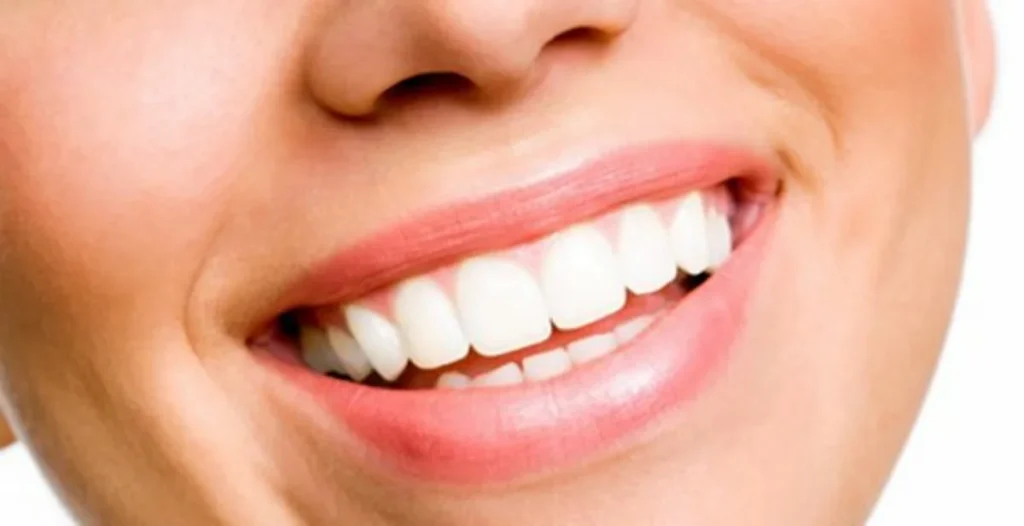 I Segreti per un Sorriso Splendente