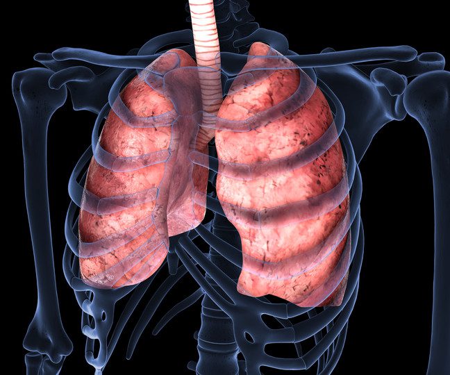 Malattie Polmonari Interstiziali
