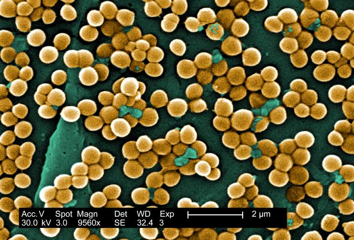 Cellule di Staphylococcus aureus fotografate al microscopio elettronico a scansione