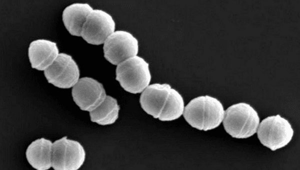 Cellule di Streptococcus pyogenes, conosciuto anche come Streptococco beta emolitico di gruppo A, fotografate al microscopio elettronico a scansione