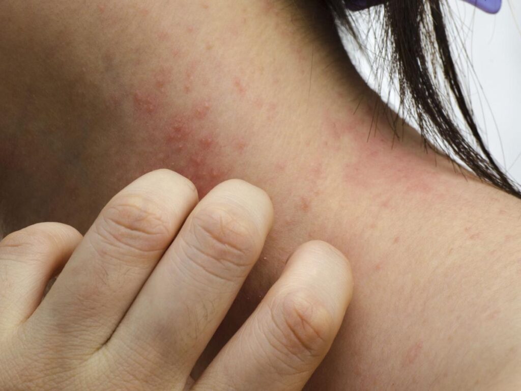 Patologie Dermatologiche negli Anziani