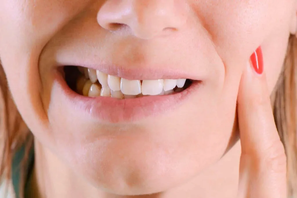 Il Bruxismo Notturno