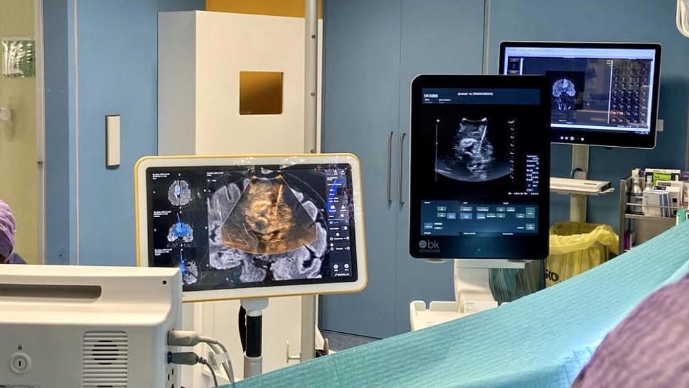 Approcci nella Chirurgia dei Tumori Cerebrali: